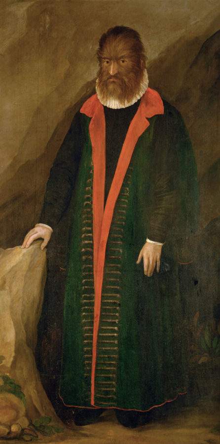 پرتره پتروس گونسالووس، 1580، موزه کانزیستریش، اتریش - رنگانا